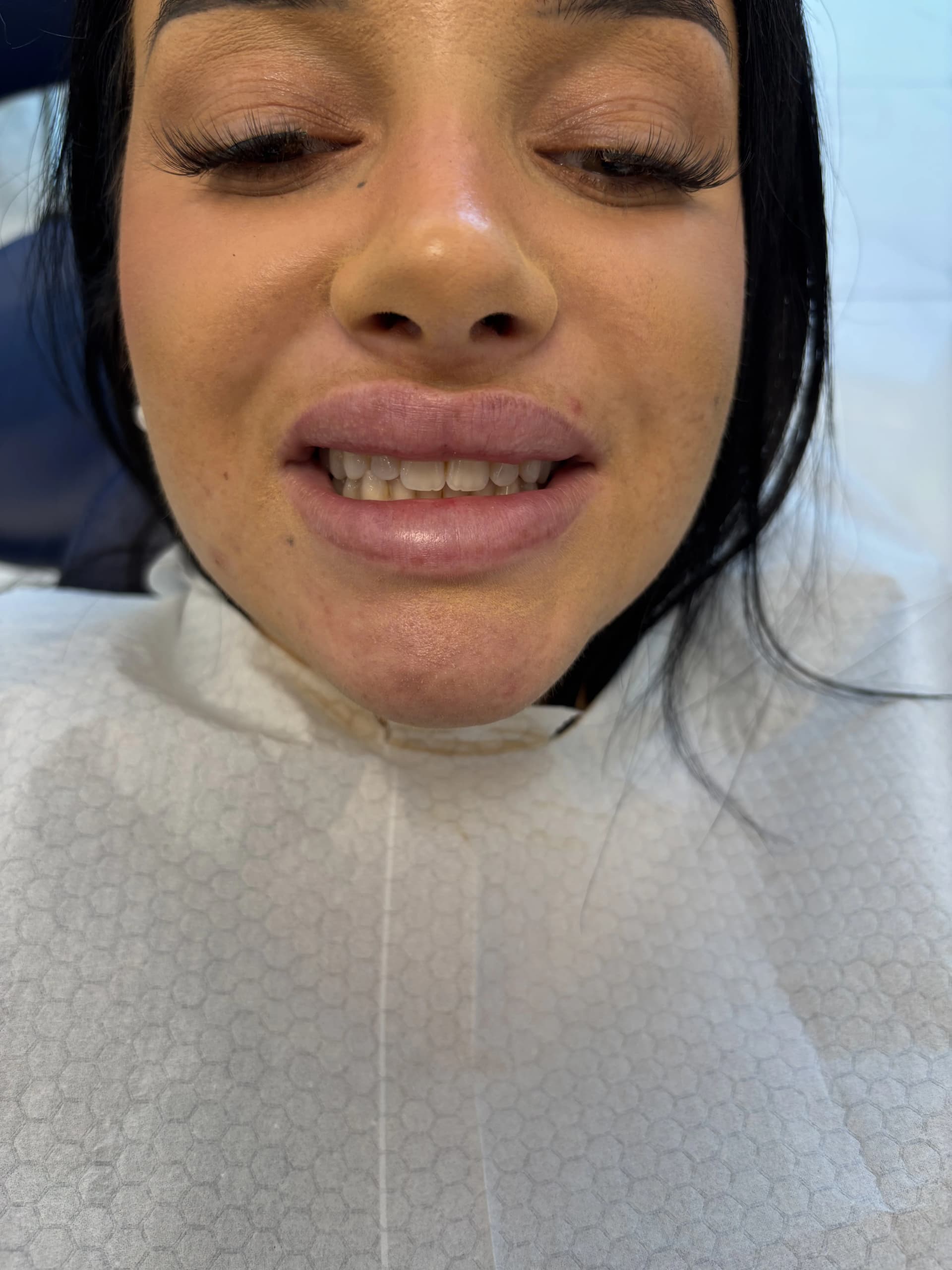 Smile makeover before — case 29, partner clinic, Istanbul