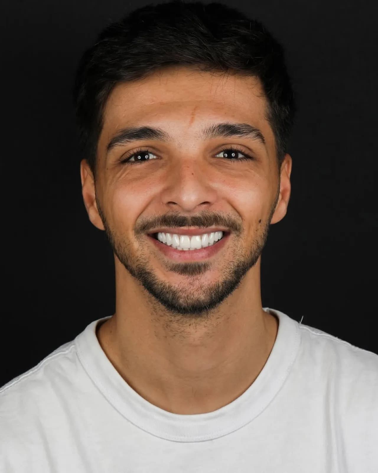 Porcelain veneers after result, full face smiling portrait of male patient, Turkey dental clinic.