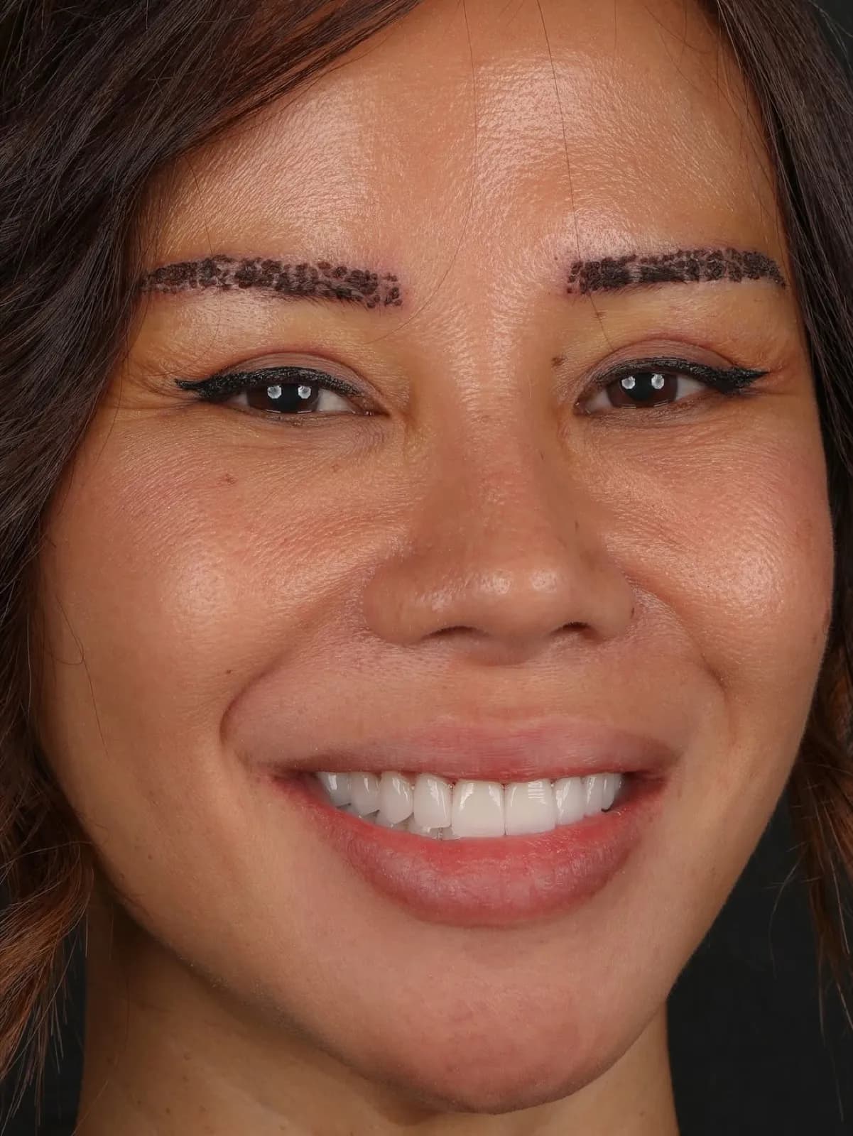 Porcelain veneers after result, full face close-up portrait of female patient smiling, Turkey dental clinic.