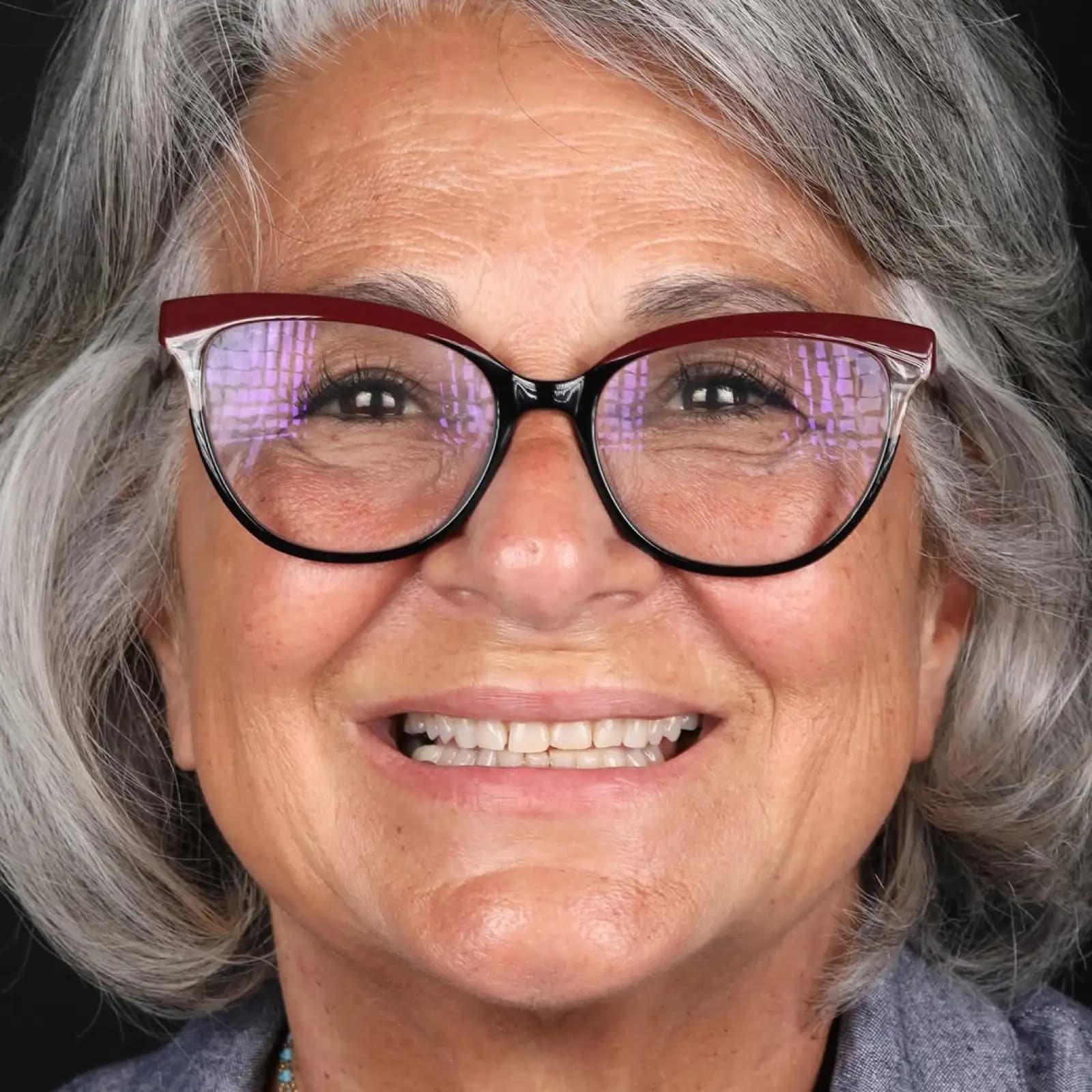Before veneer treatment, full face close-up portrait of mature female patient wearing glasses, Turkey dental clinic.