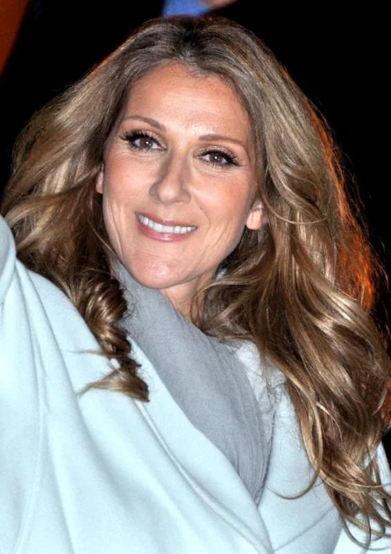 Celine Dion's Teeth: The Smile Transformation Behind a Career-Long Glow-Up