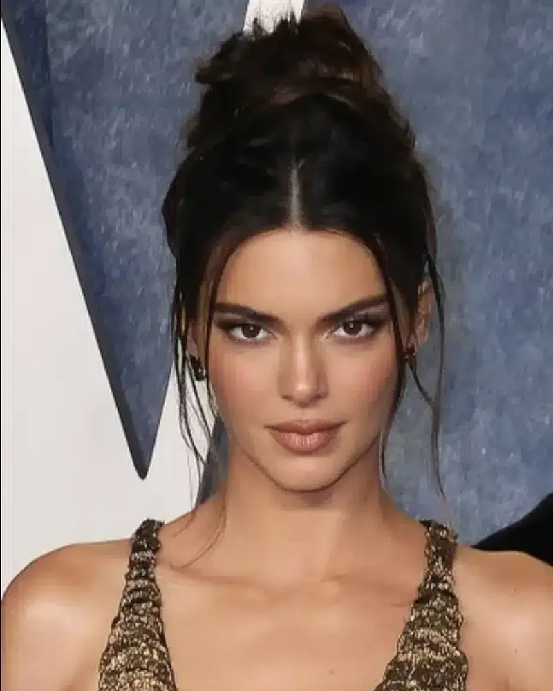Kendall Jenner smile geometry — modern facial harmony and dental proportions