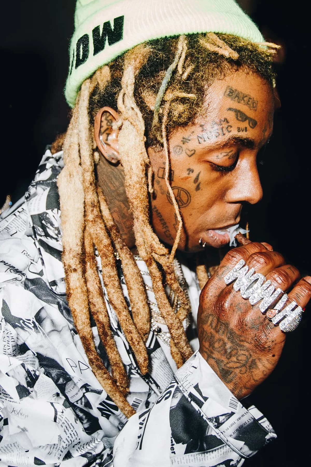 Lil Wayne's Teeth: Diamond Implants, Grills, and the Real Cost of a Permanent Smile