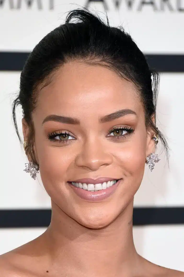 Rihanna bold smile gum health dental aesthetics