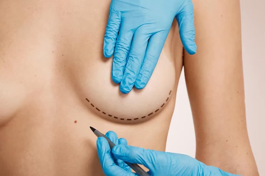 Breast Reduction Surgery in Turkey