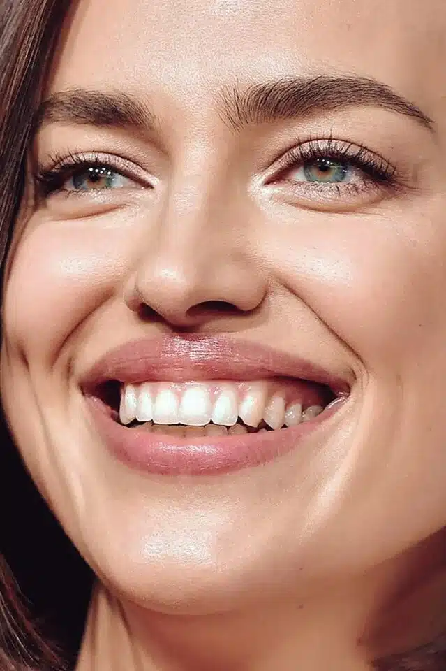 irina shayk aesthetic signature smile