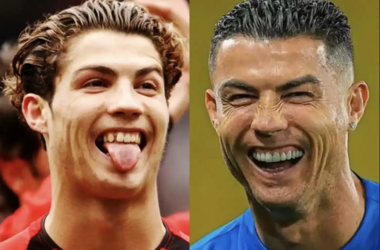 Cristiano Ronaldo Smile Makeover