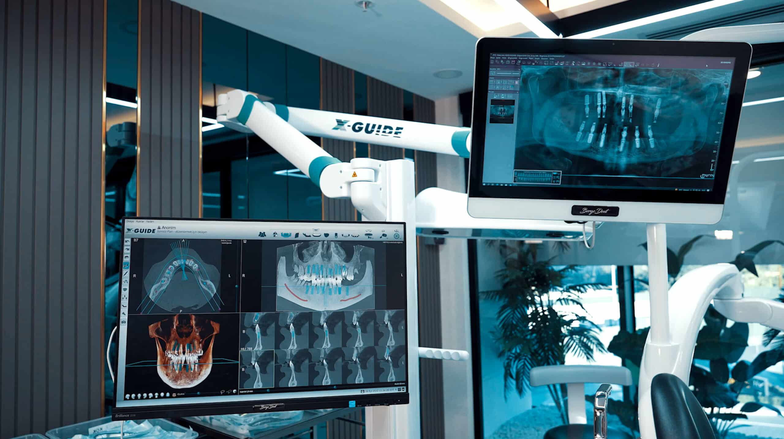 dental implants in turkey