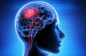 brain tumor surgery