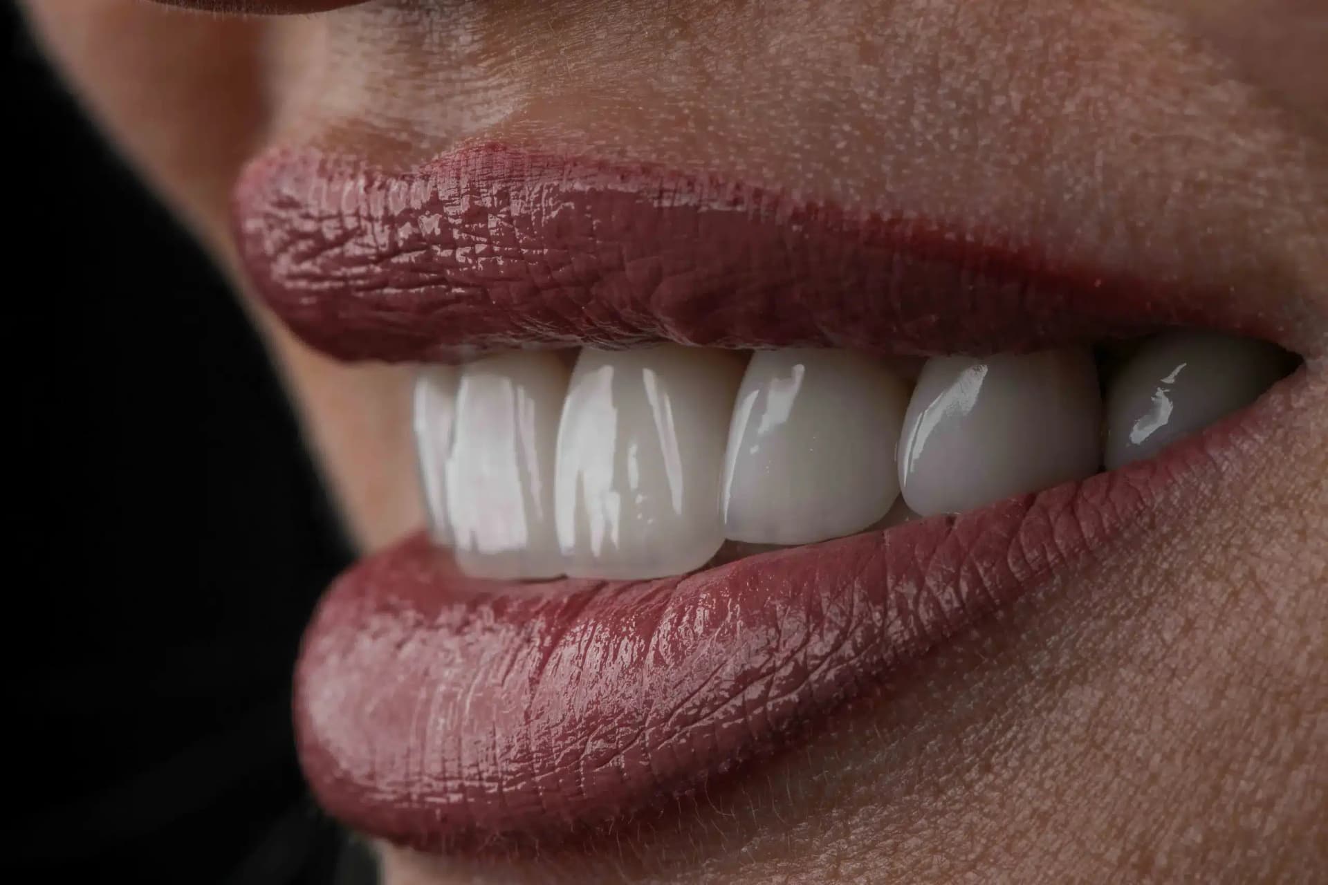 Hollywood Smile Concept