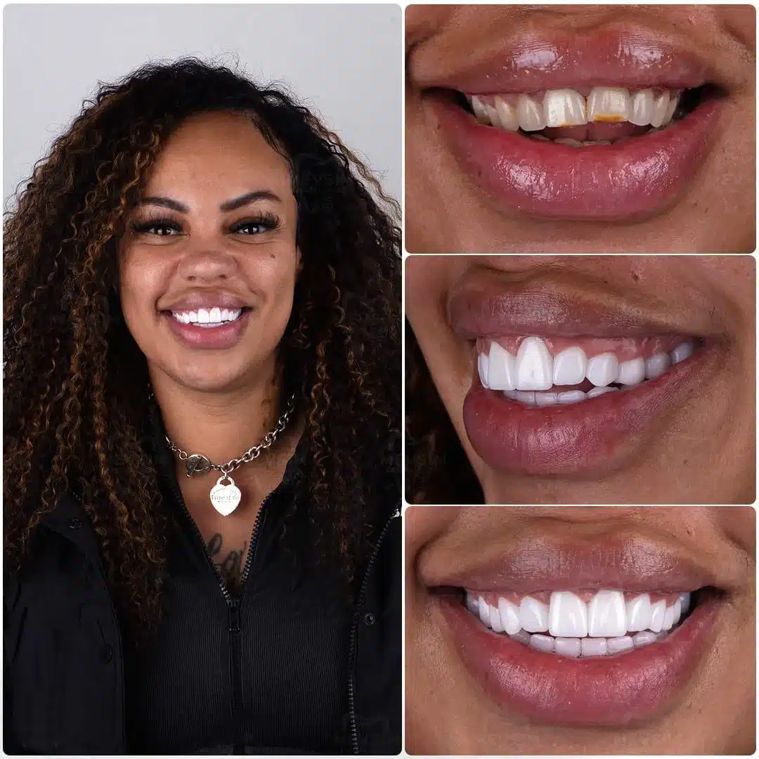 christian ronaldo dental