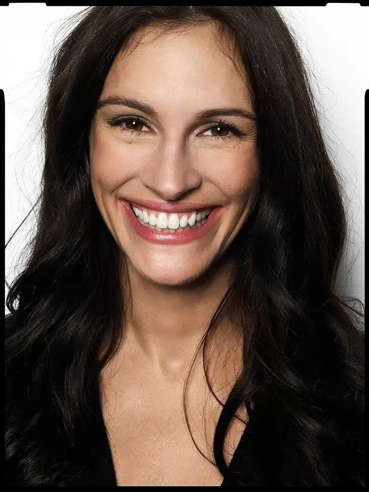 “Julia Roberts showing full dental arch during a wide, happy laugh.”