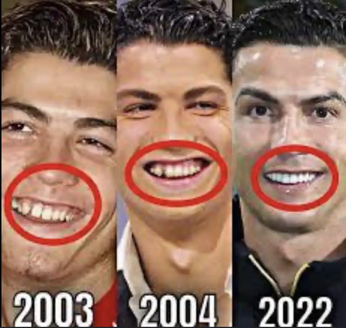Cristiano Ronaldo Smile Makeover