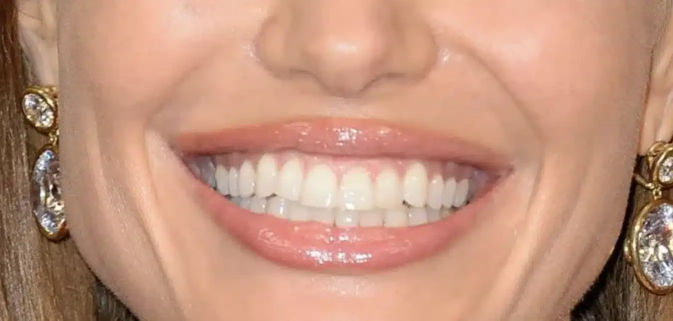 “Angelina Jolie’s elegant feminine smile with subtle shade gradients.”