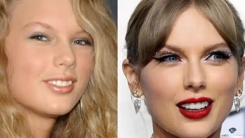 2. “Close-up of Taylor Swift showing natural incisor geometry.”