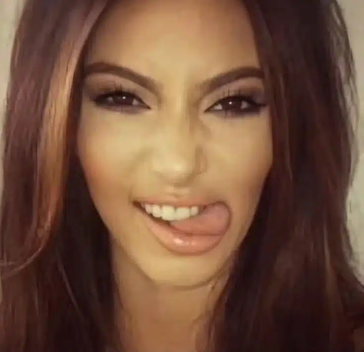 Full Mouth Dental Implant Risks and Complications: A Realistic Overview