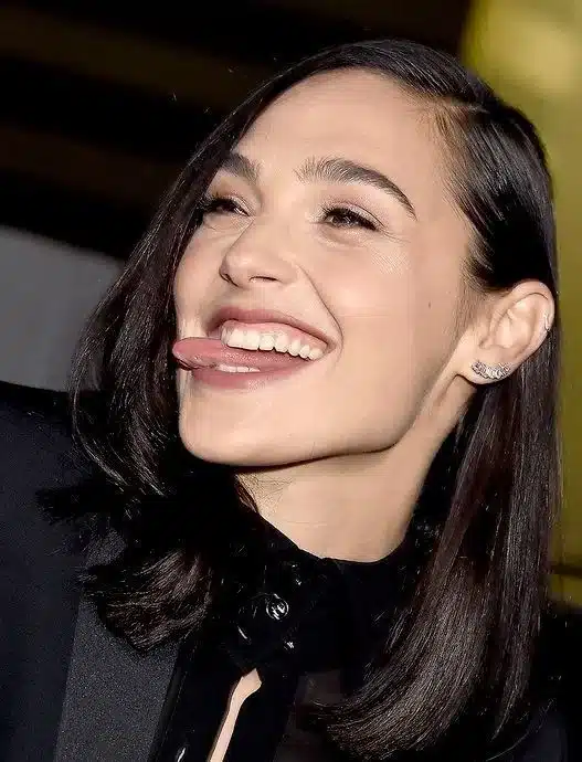 Life After Full Mouth Dental Implants