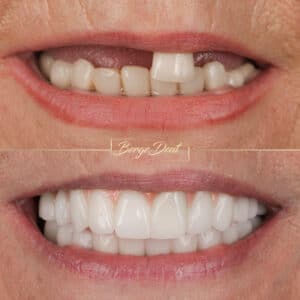 dental service turkey