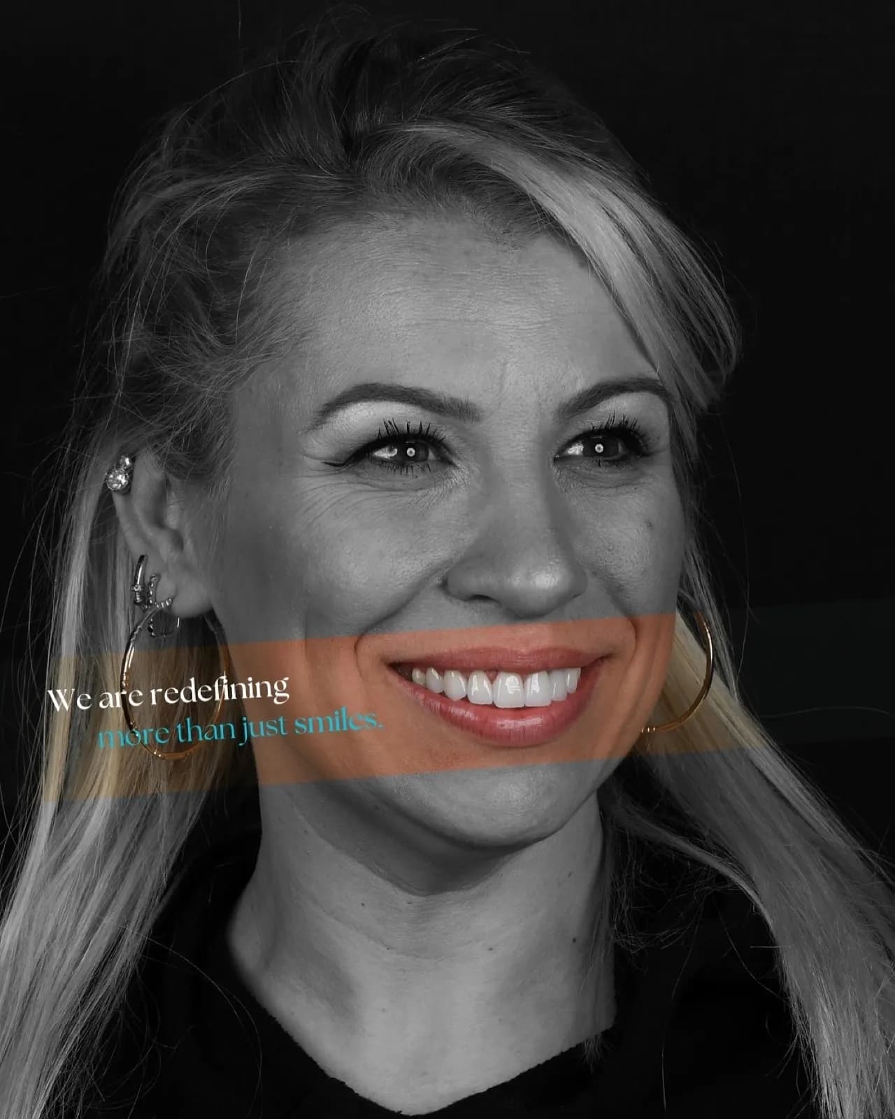 Smile makeover after result, full face portrait of female patient smiling with white teeth, marketing text overlay, Turkey dental clinic.
