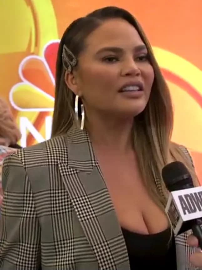 Chrissy Teigen's Veneers: An Honest Look at Her Smile Upgrade