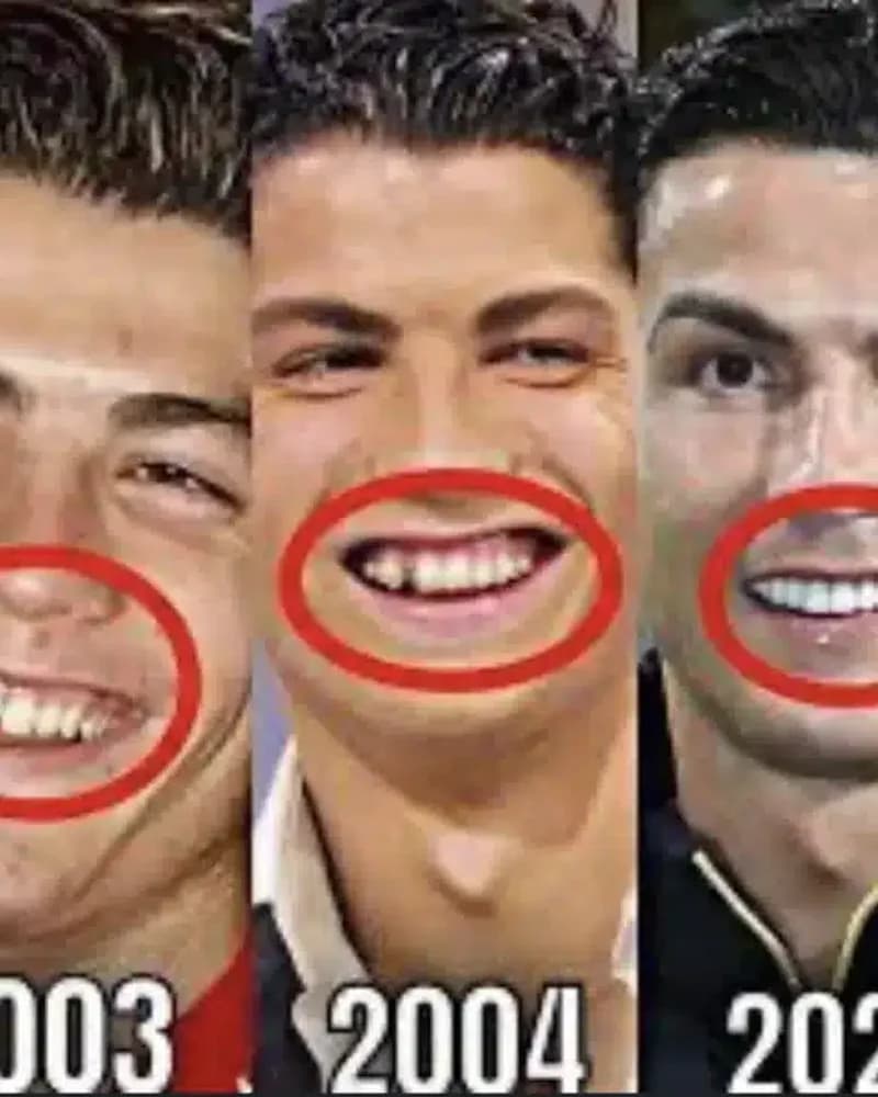 Cristiano Ronaldo dental transformation before and after analysis