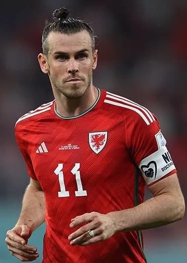 Gareth Bale's Teeth: The Footballer's Smile Upgrade Explained