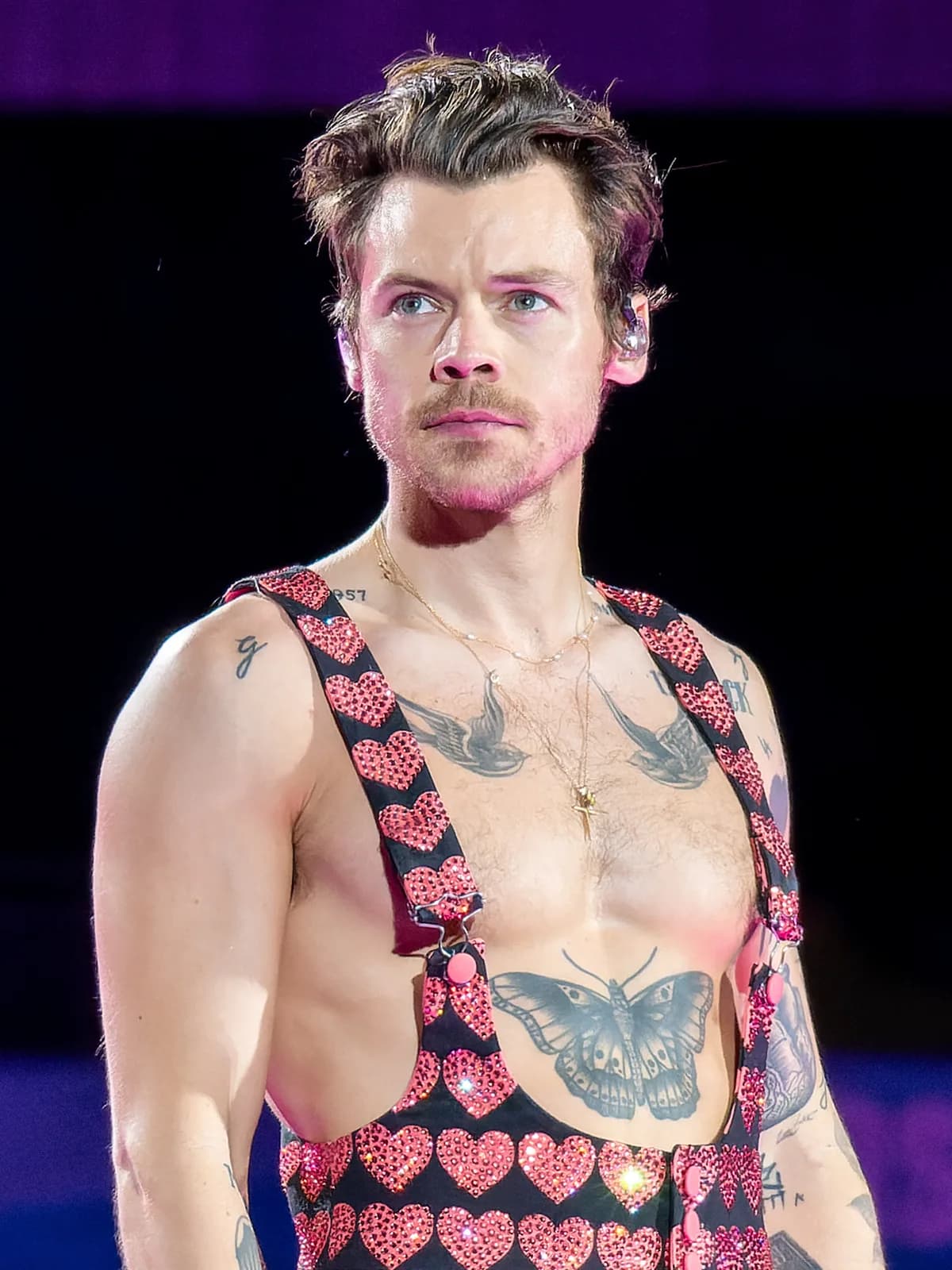 Harry Styles's Teeth: The Braces-to-Star Smile Transformation