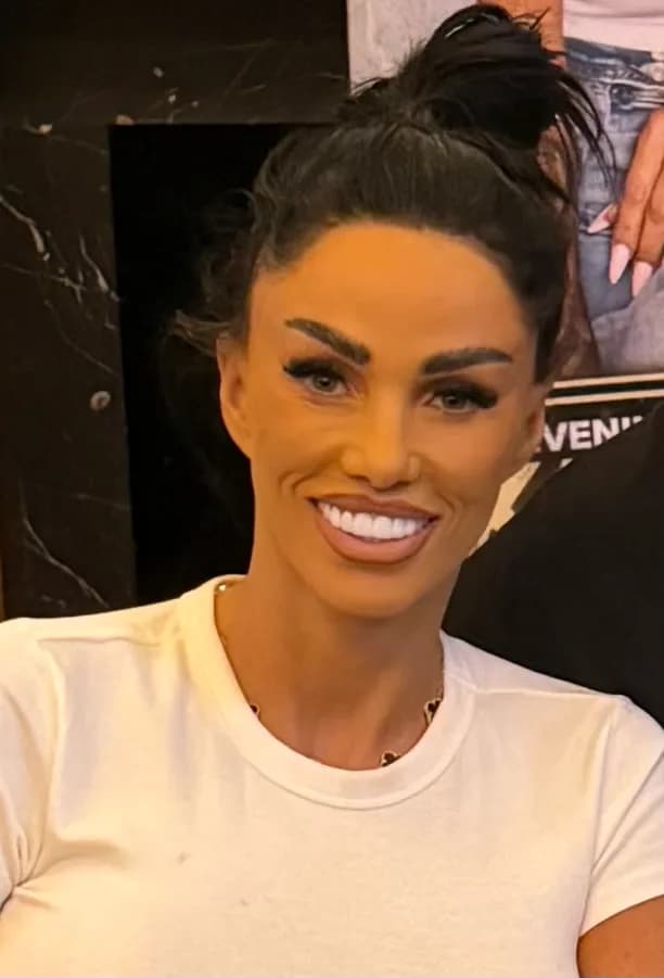 Katie Price's Teeth: A Veneer Journey and the Truth About Maintenance