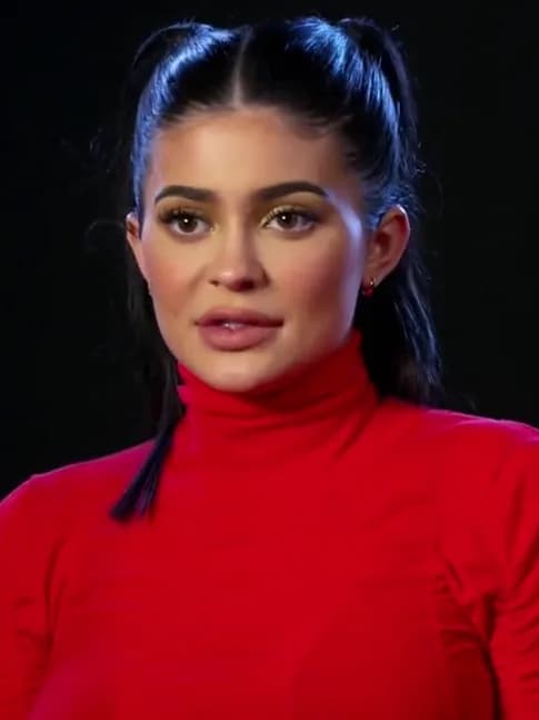 Kylie Jenner's Teeth: Veneers at a Young Age — and What to Consider First