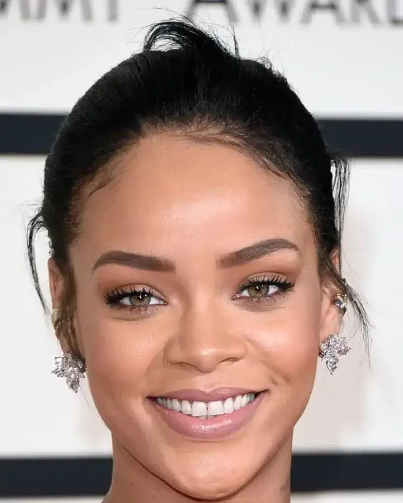 Rihanna bold smile gum health dental aesthetics