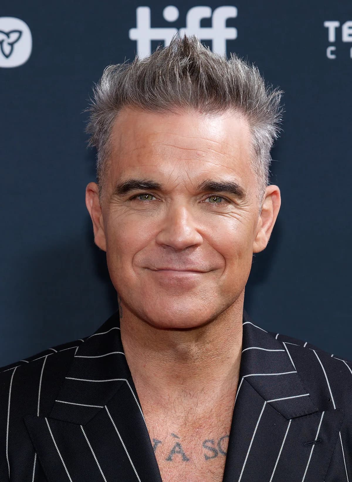 Robbie Williams's Teeth: The Pop Star Who Was Open About His Veneers
