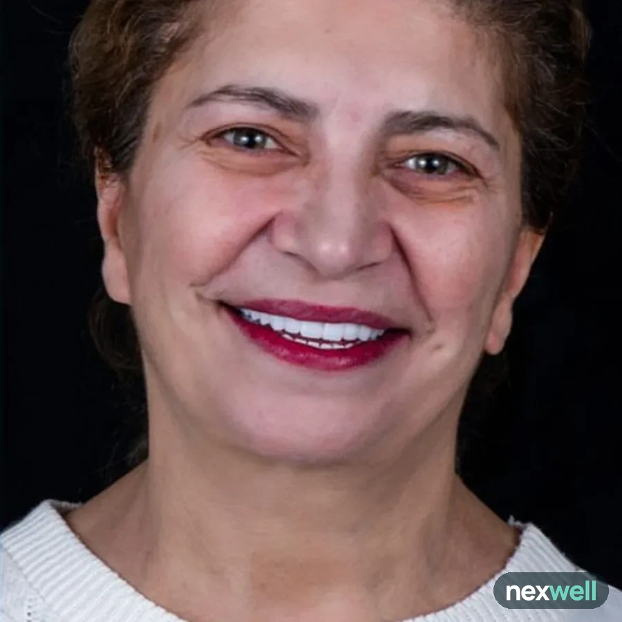After: full mouth All-on-6 implant restoration, 2002