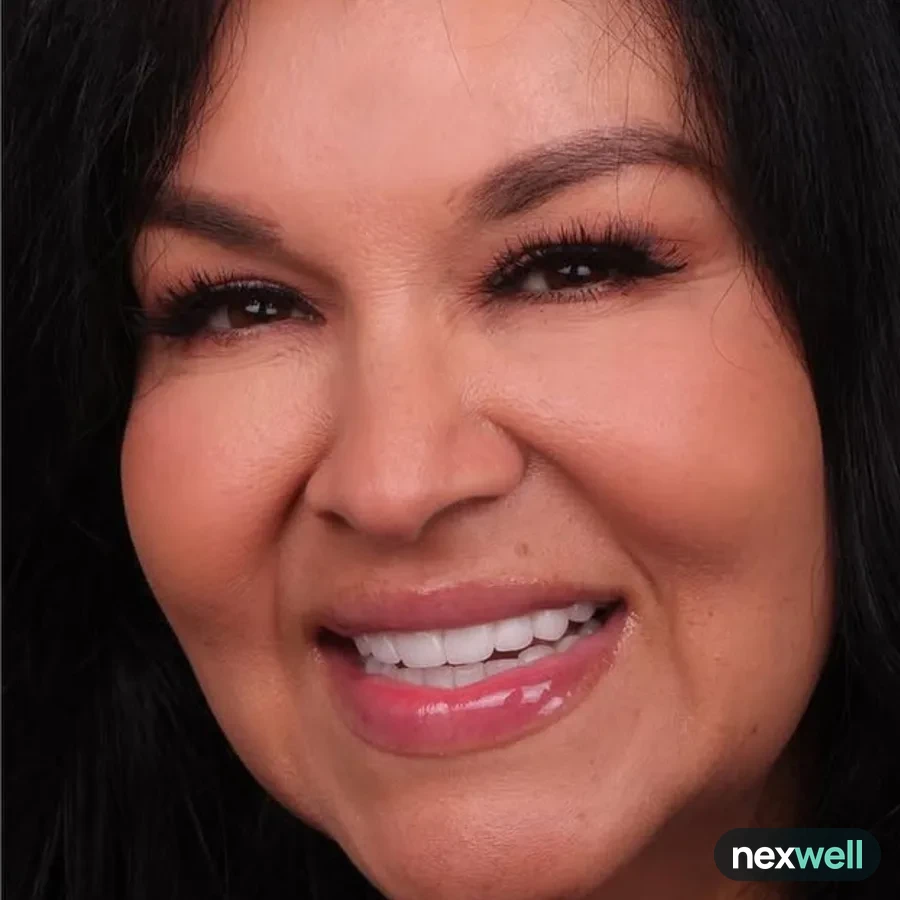 After: full mouth All-on-6 implant restoration, 2012