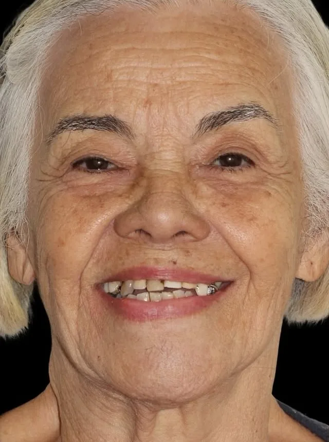 Dental patient 5582 before treatment at a NexWell contracted clinic