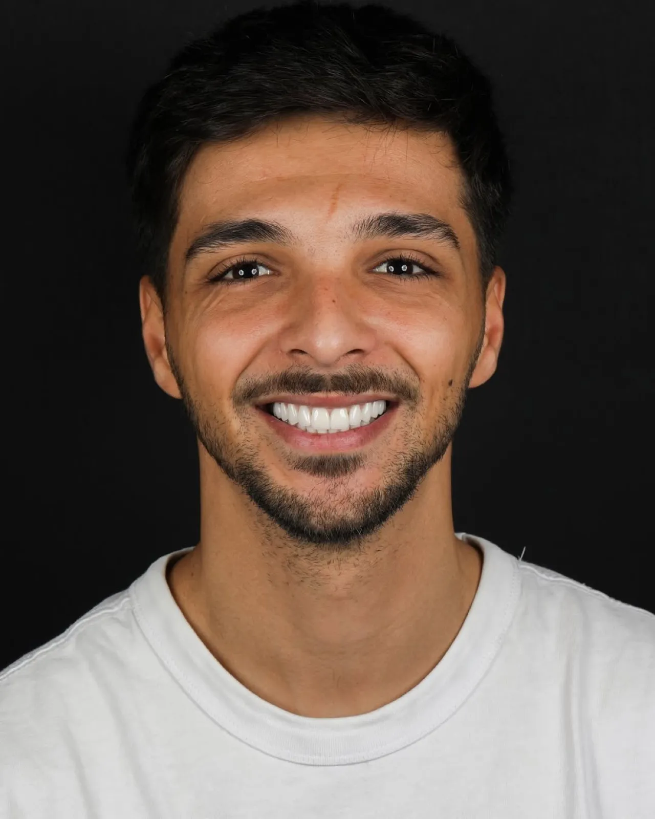 Porcelain veneers after result, full face smiling portrait of male patient, Turkey dental clinic.
