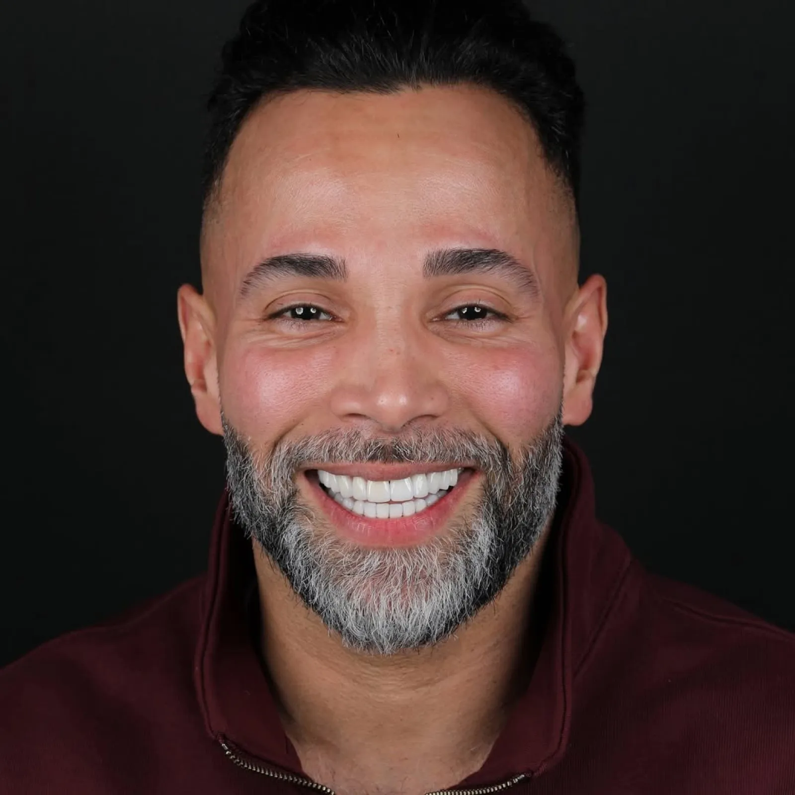 Porcelain veneers after result, full face smiling portrait of male patient with beard, Turkey dental clinic.