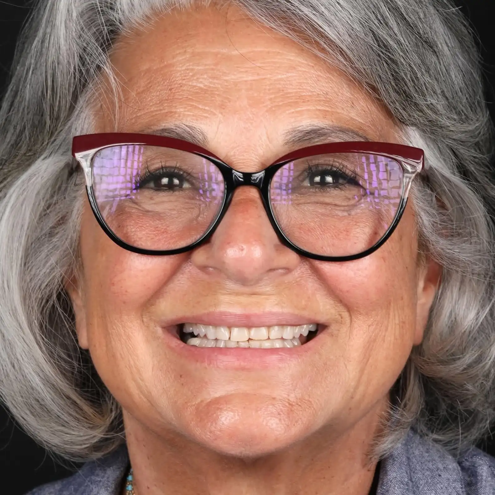 Before veneer treatment, full face close-up portrait of mature female patient wearing glasses, Turkey dental clinic.