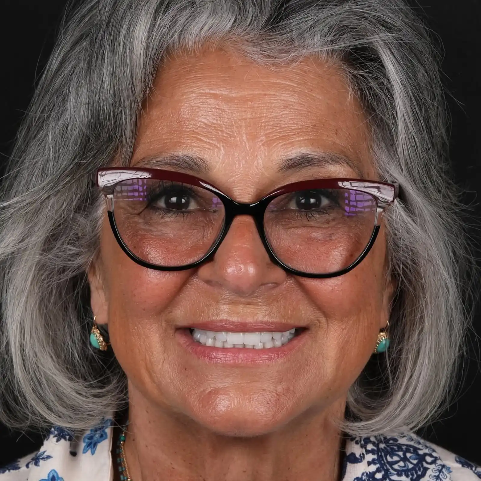 Porcelain veneers after result, full face close-up portrait of mature female patient wearing glasses and smiling, Turkey dental clinic.