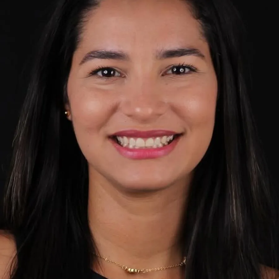 Before: veneer and zirconia smile restoration, 3003