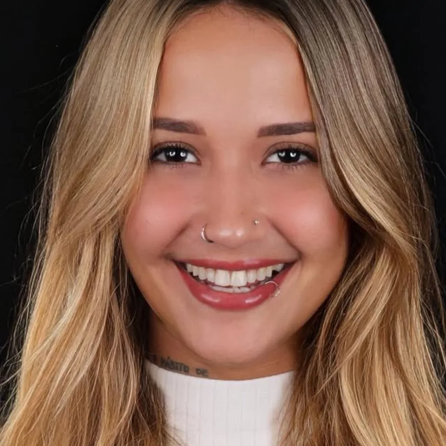 Before: veneer and zirconia smile restoration, 3006