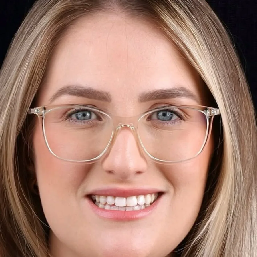 Before: veneer and zirconia smile restoration, 3011