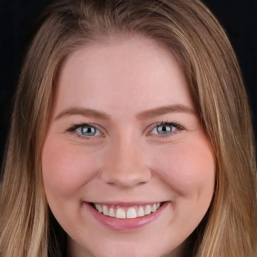 Before: veneer and zirconia smile restoration, 3015