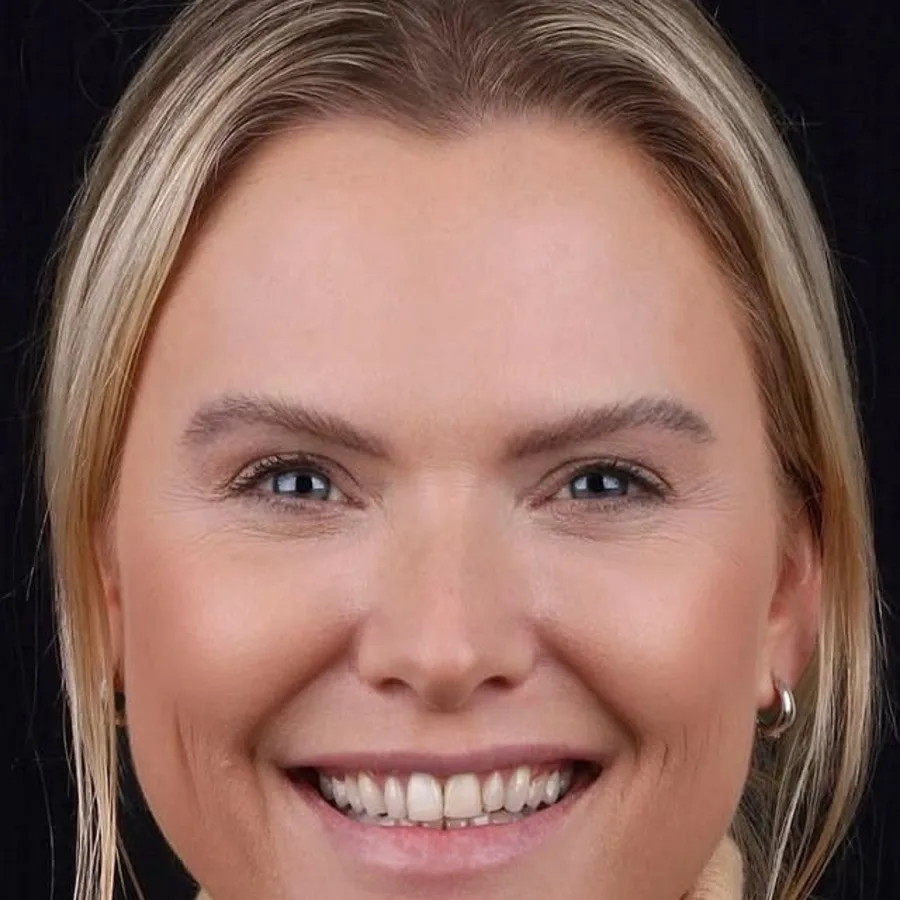 Before: veneer and zirconia smile restoration, 3016
