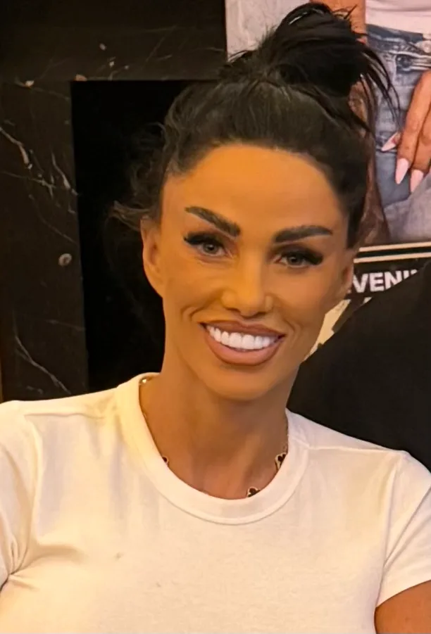 Katie Price's Teeth: A Veneer Journey and the Truth About Maintenance