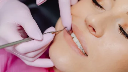 Dentist in gloves working on a patient's upper teeth with a hand instrument during a dental procedure