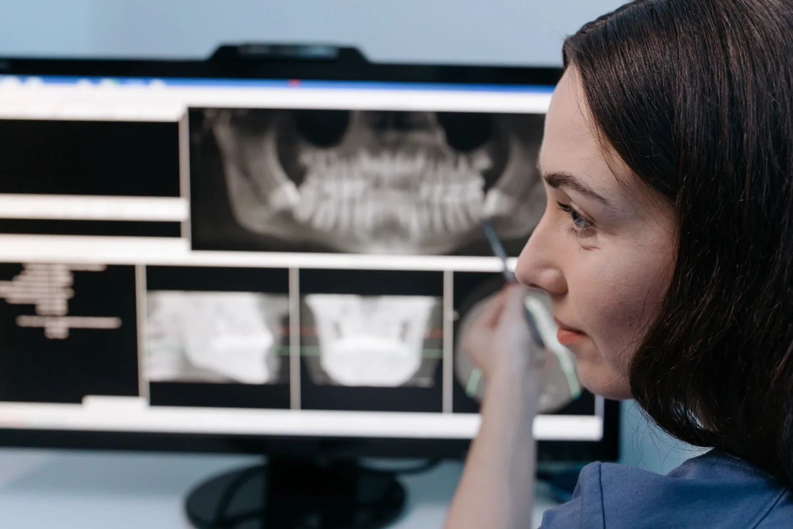 A clinician reviewing a panoramic dental X-ray on screen to assess bone volume before implant placement
