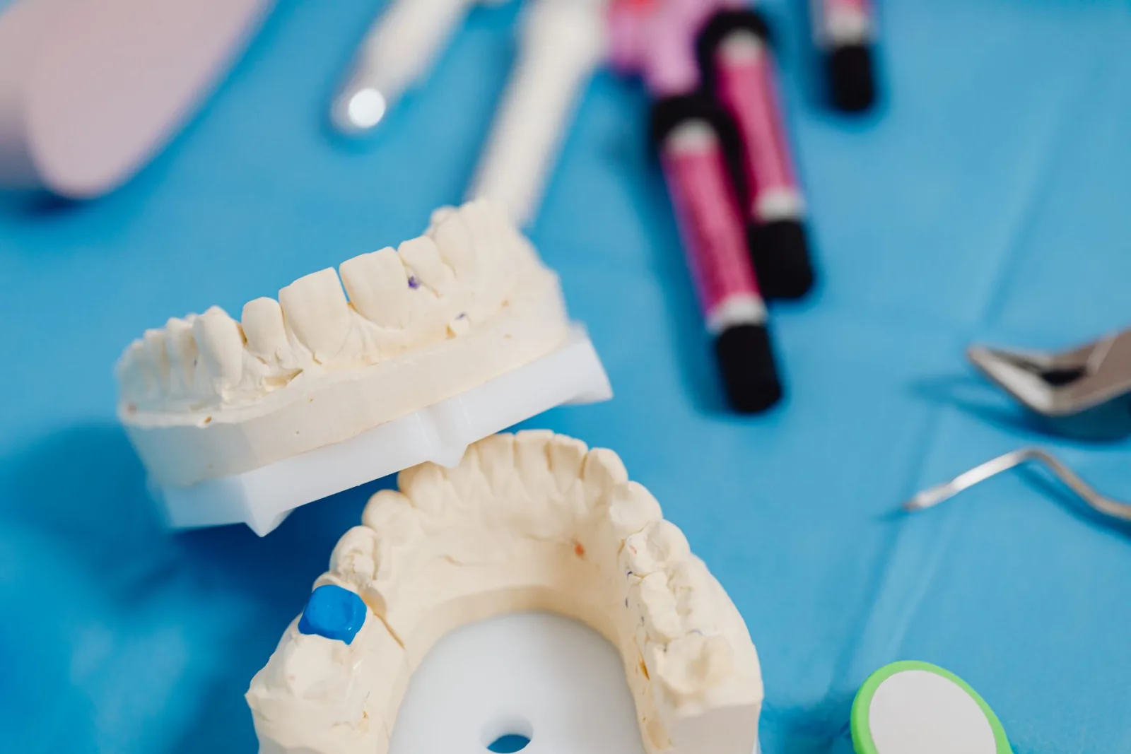Full-arch dental prosthesis model compared with a single-implant crown