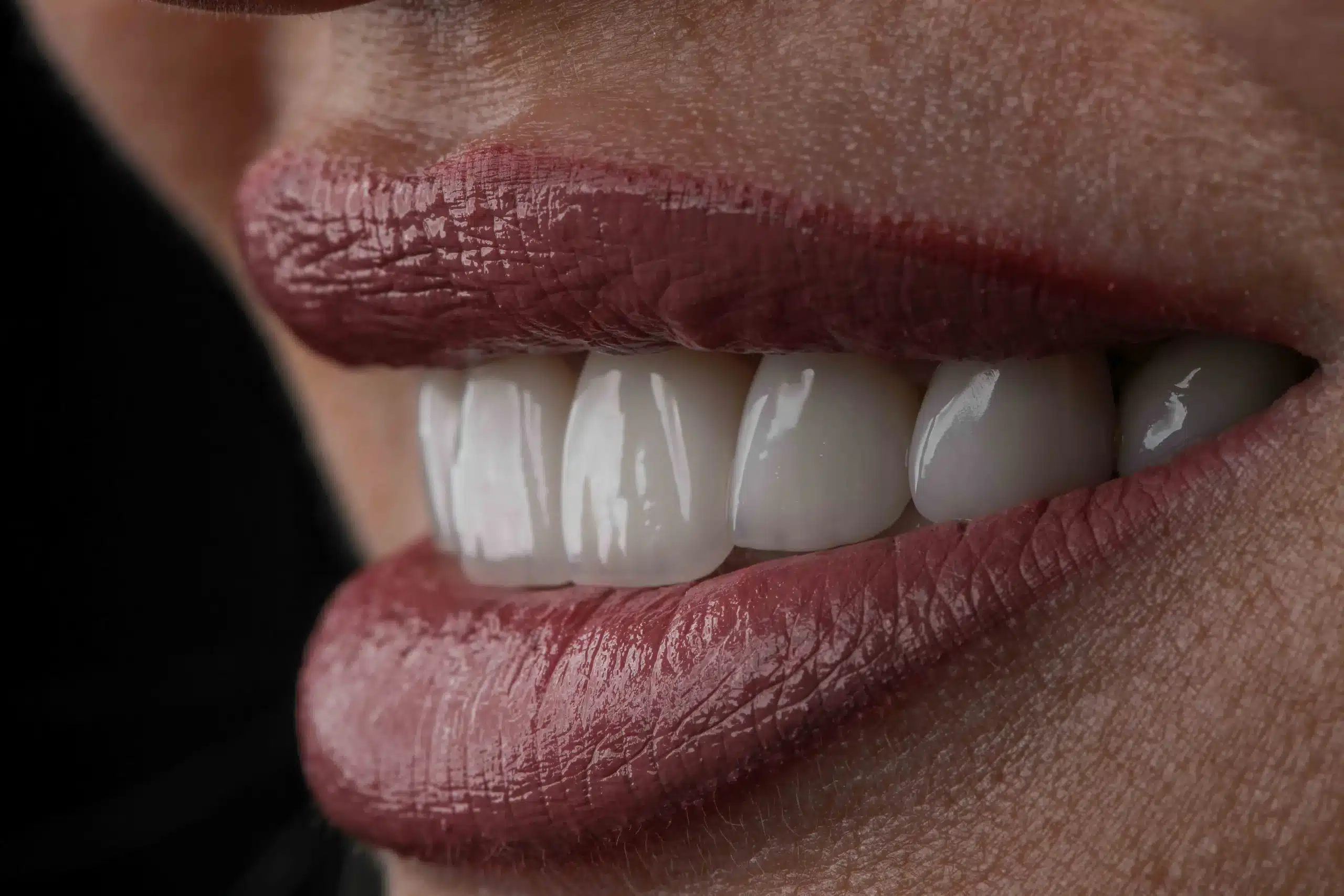 Hollywood Smile Concept