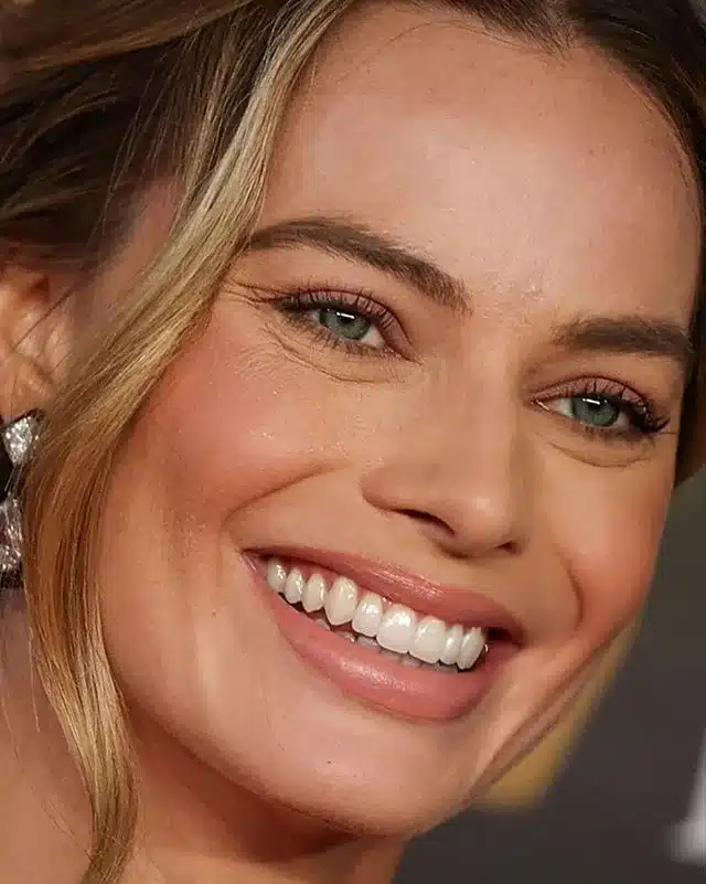 “Close-up of Margot Robbie showing warm enamel tones and balanced smile.”