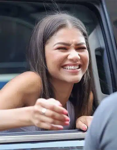 “Zendaya’s gentle smile emphasizing feminine dental curves.”